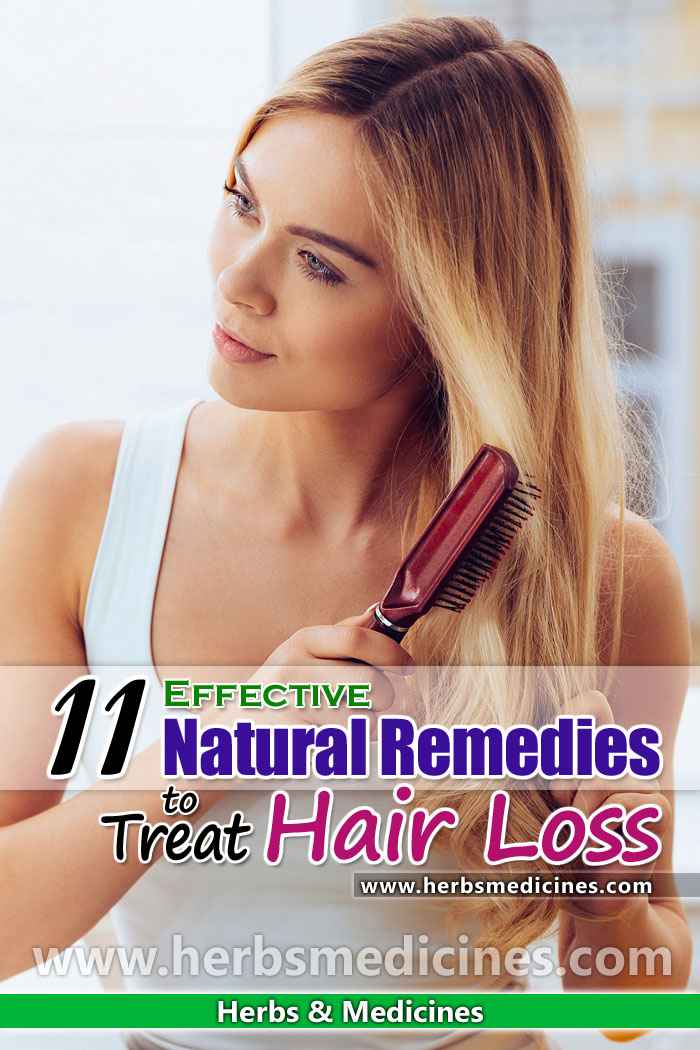 Best Hair Loss Remedies
